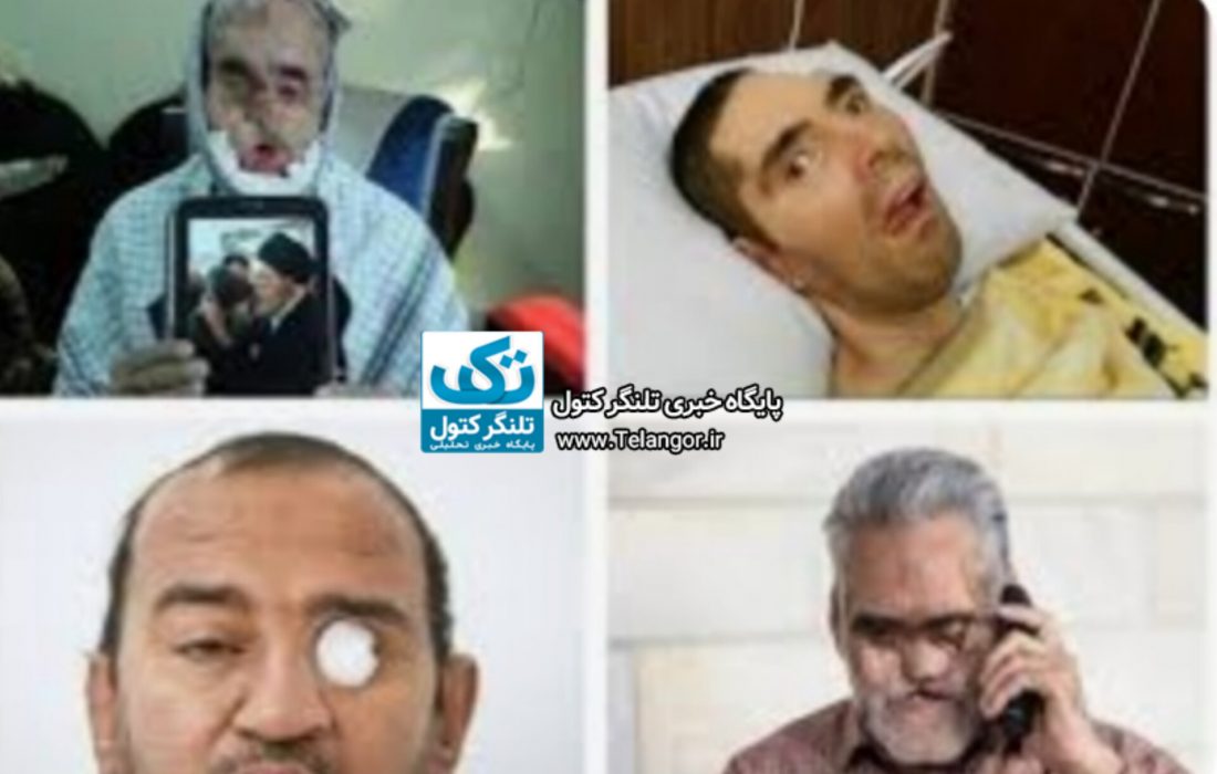 استاندار گلستان: جانبازان هیچگاه امامین انقلاب اسلامی را تنها نگذاشتند